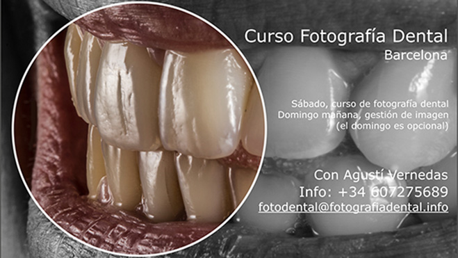 Curs-Foto-Dental-BCN-2017-04.w.jpg