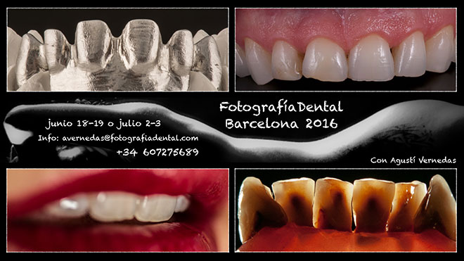 curs-foto-dental-bcn-2016-06-01mini.jpg
